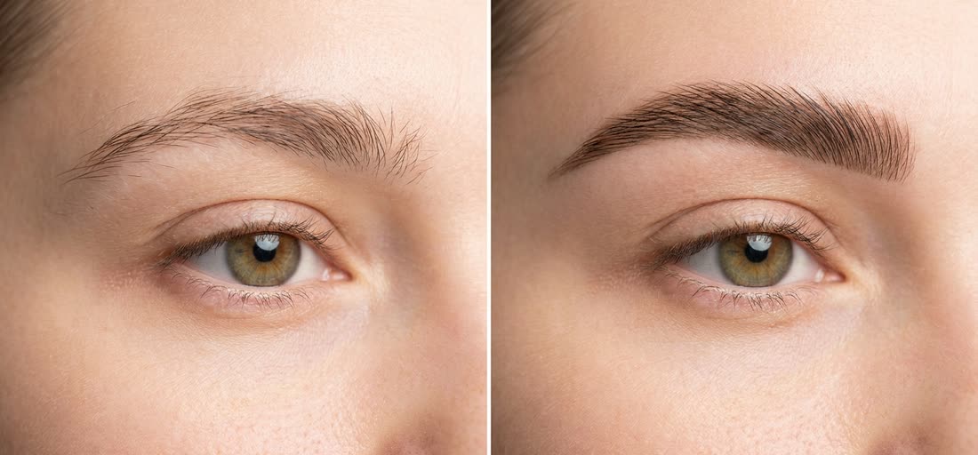 Brow Lifting vorher und nachher: links ungeordnete Brauenhaare, rechts nach oben gelegt, voller und getönt